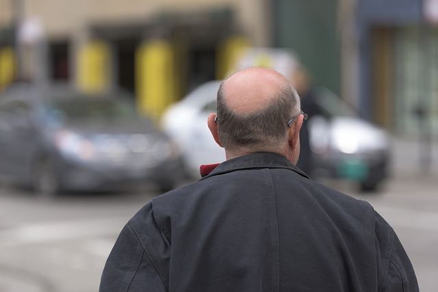 homme avec une calvitie