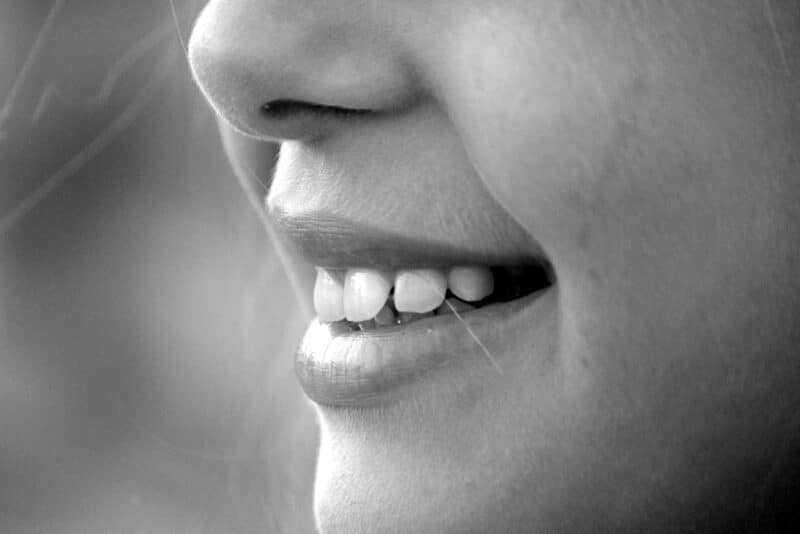 dents