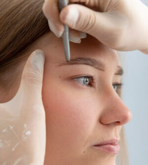 formation Brow Lift
